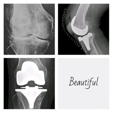 Slider image (7) Dr. Rodrigo Aguirre Rojas Orthopedic Surgeon